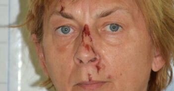 Policija utvrdila identitet žene pronađene na Krku Žena pronađena na Krku